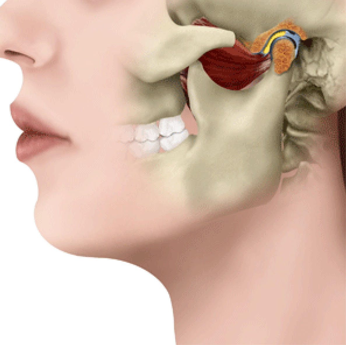 Disfunção temporomandibular: saiba quais são os sintomas – Sorridents