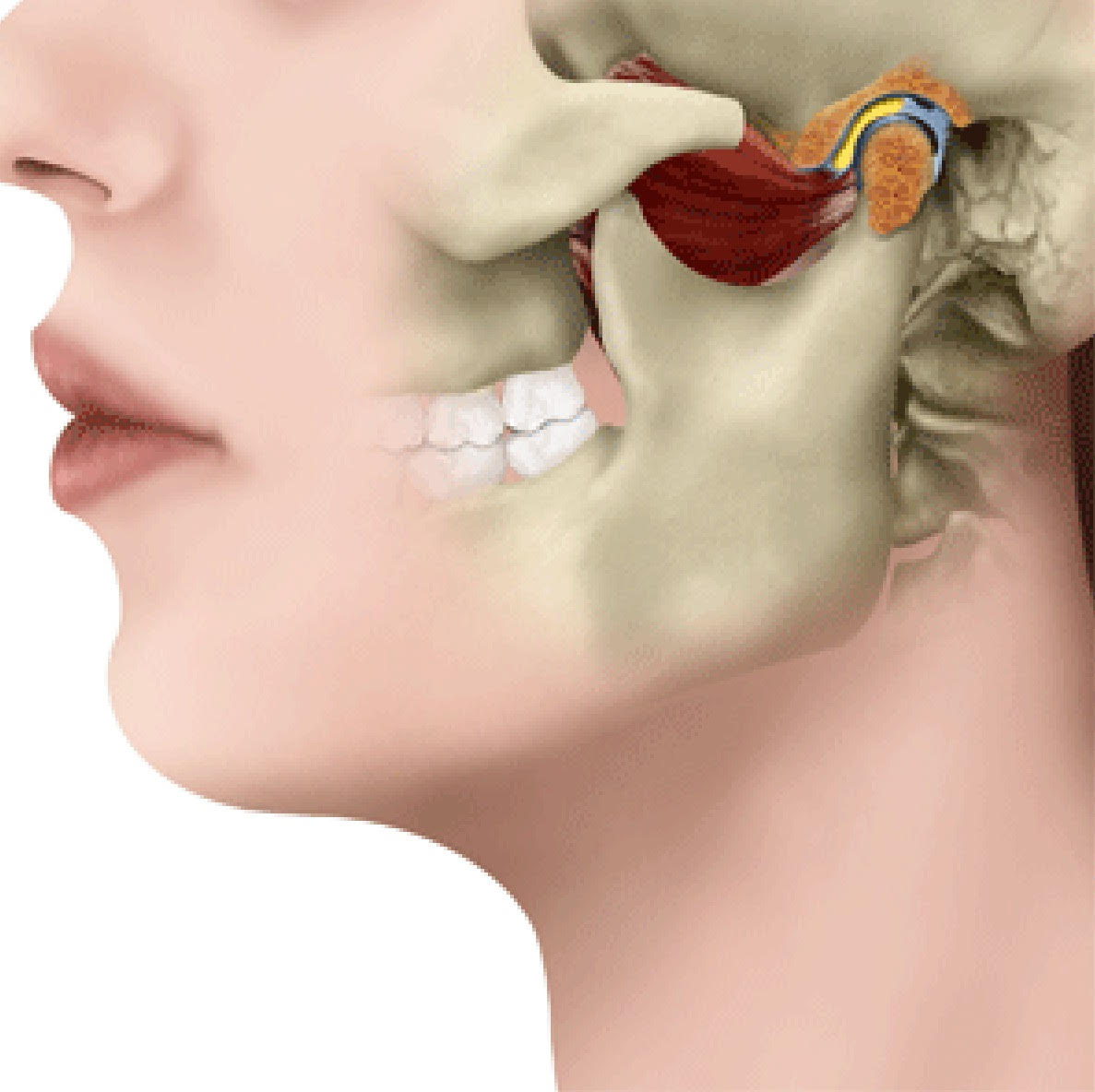 DTMSbaraini - Problemas crônicos na ATM costumam ser classificados como  Disfunção da Articulação Temporomandibular (DTM). Aqui, estão incluídos  sintomas como mandíbula estalando, dores de cabeça frequentes e até mesmo  dificuldades para abrir